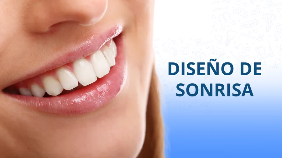 Sonrisa después de un blanqueamiento dental profesional