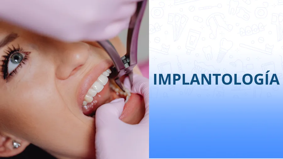 Procedimiento de extracción dental de tercer molar